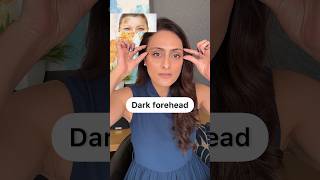 Dark forehead | How to improve | creams to use