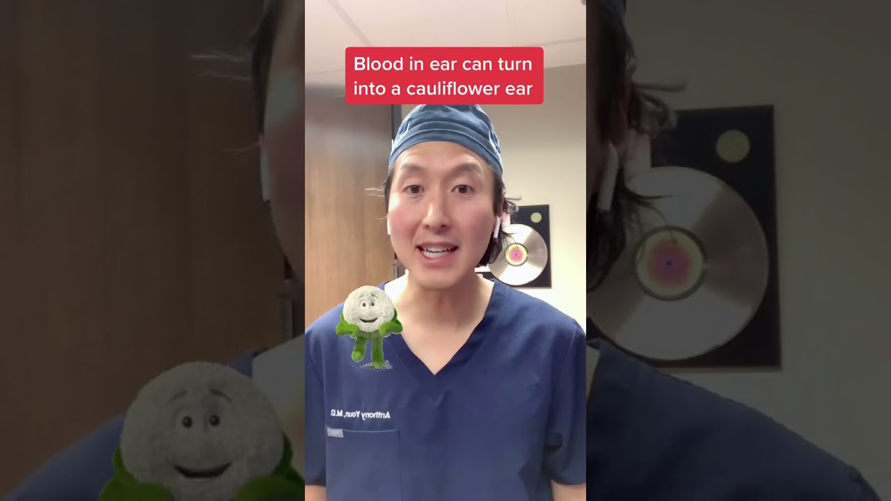 Is This The Way To Prevent Cauliflower Ear Shorts