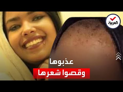 الحوثيون يضربون الفنانة انتصار الحمادي ويحلقون شعرها
 - 10:56-2022 / 1 / 20