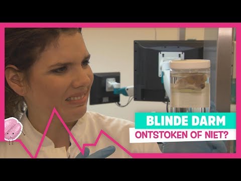 BLINDE DARM ONTSTEKING - TOPDOKS EXTRA