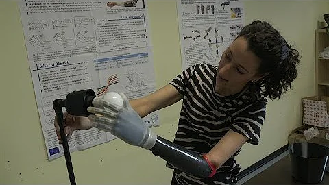 Como funciona Os sensores de uma prótese de um braço mecânico para que possa executar determinados movimentos?