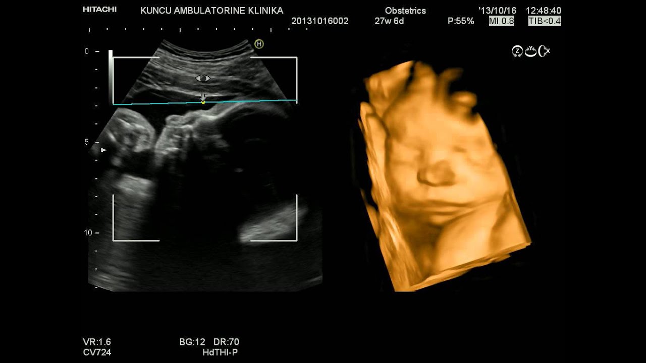 My baby 4D ultrasound 28 weeks (part4) YouTube
