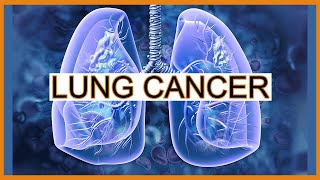 Kanker/Tumor Paru-paru
