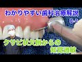 歯がしみてお困りの方必見 鏡で見てこれがないですか 歯がしみてお困りの方必見 鏡で見てこれがないですか