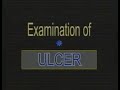 Dr vaidya  examination of an ulcer  surgery clinical examination