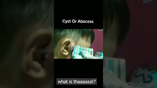 cyst or Abscess