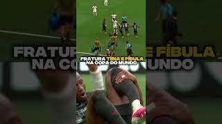 FRATURA DE TÍBIA E FÍBULA NA COPA DO MUNDO