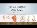 Thoracic Outlet Syndrome Explained