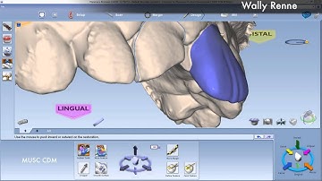 PlanScan Veneers 8 and 9