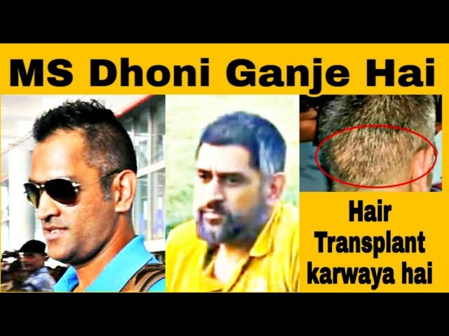 How would you rate MS Dhonis hair transplant Is it good or bad  Quora