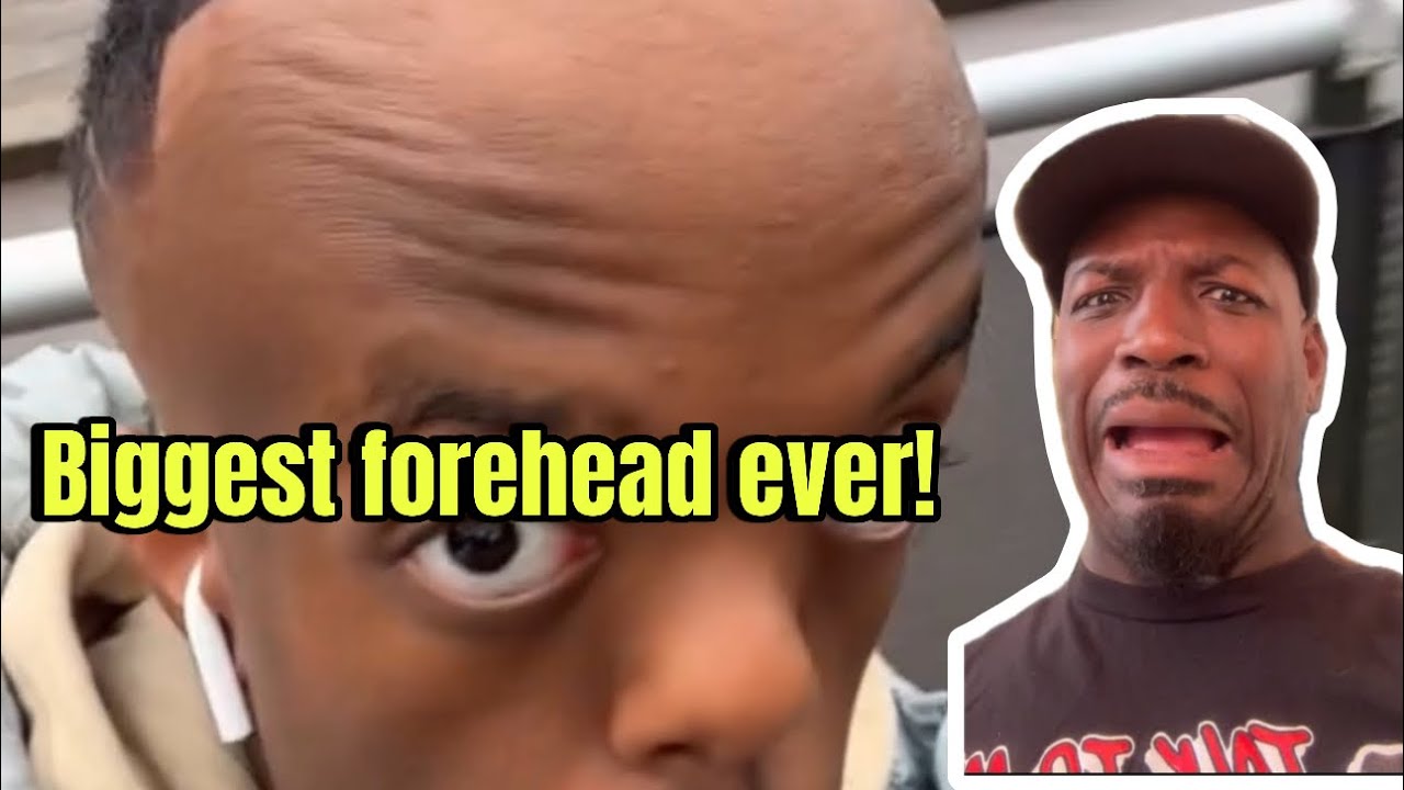 Почему у тебя такой большой лоб?! 🥴