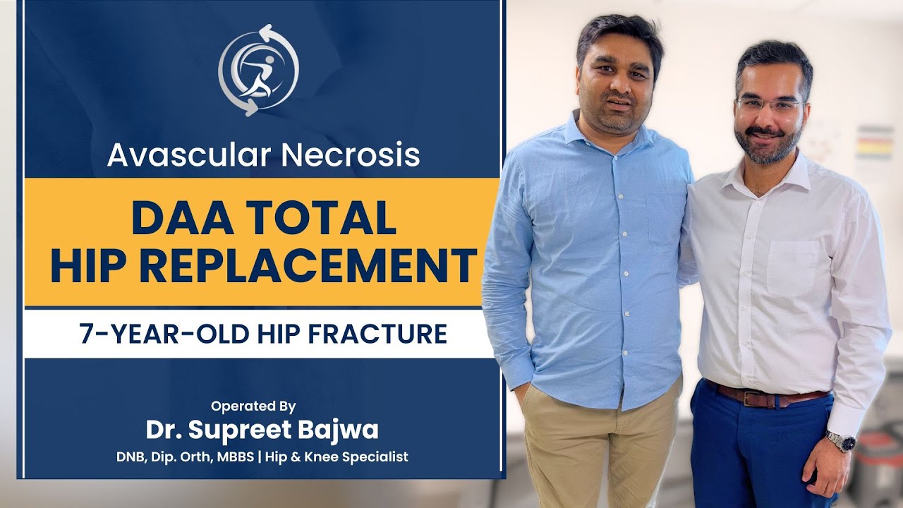 Avascular Necrosis Treatment Recovery After Hip Replacement Best Avascular necrosis treatment recovery after hip replacement best