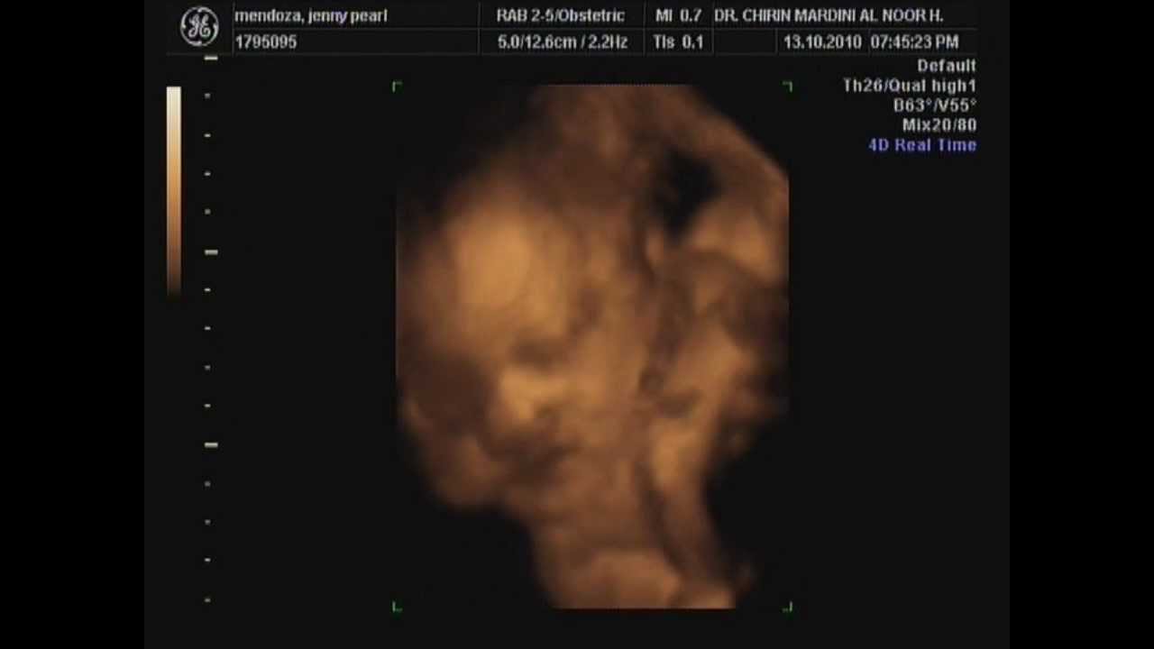 babies in mummy's tummy