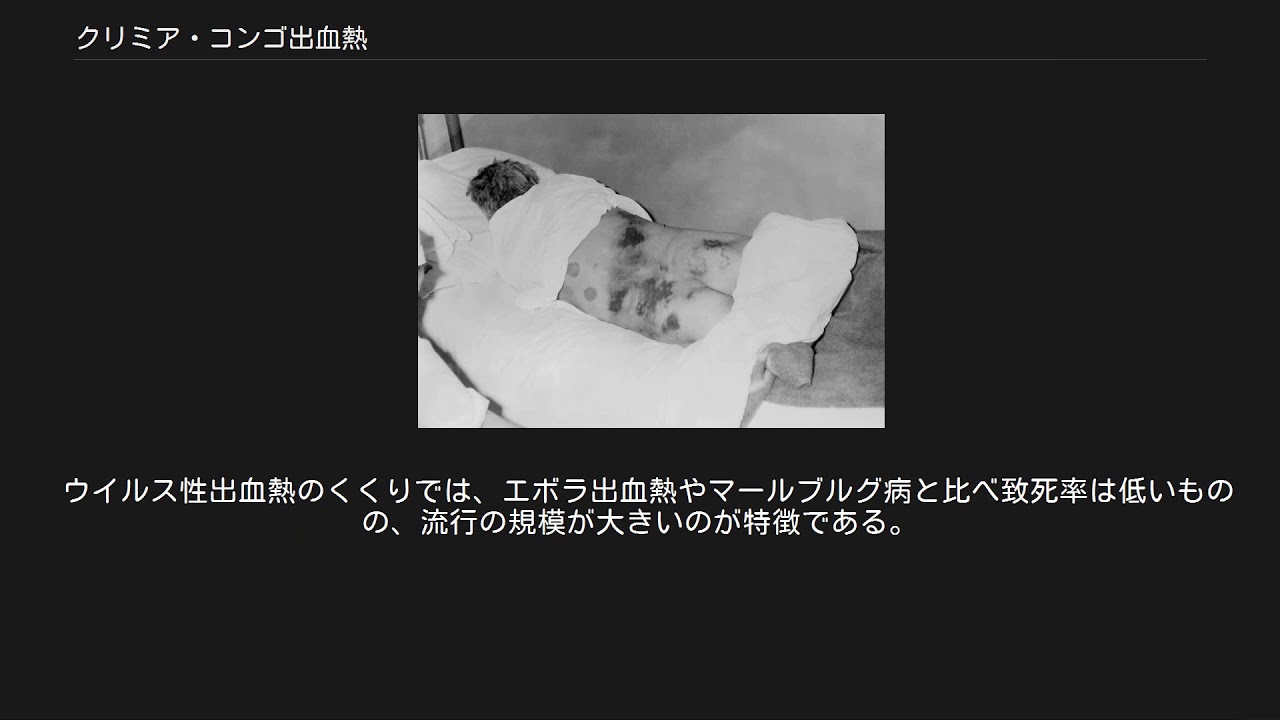 クリミア コンゴ 出血 熱