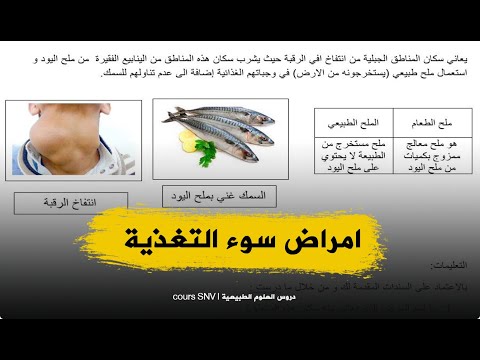 وضعية ادماجية حول امراض سوء التغذية اولى متوسط علوم طبيعية