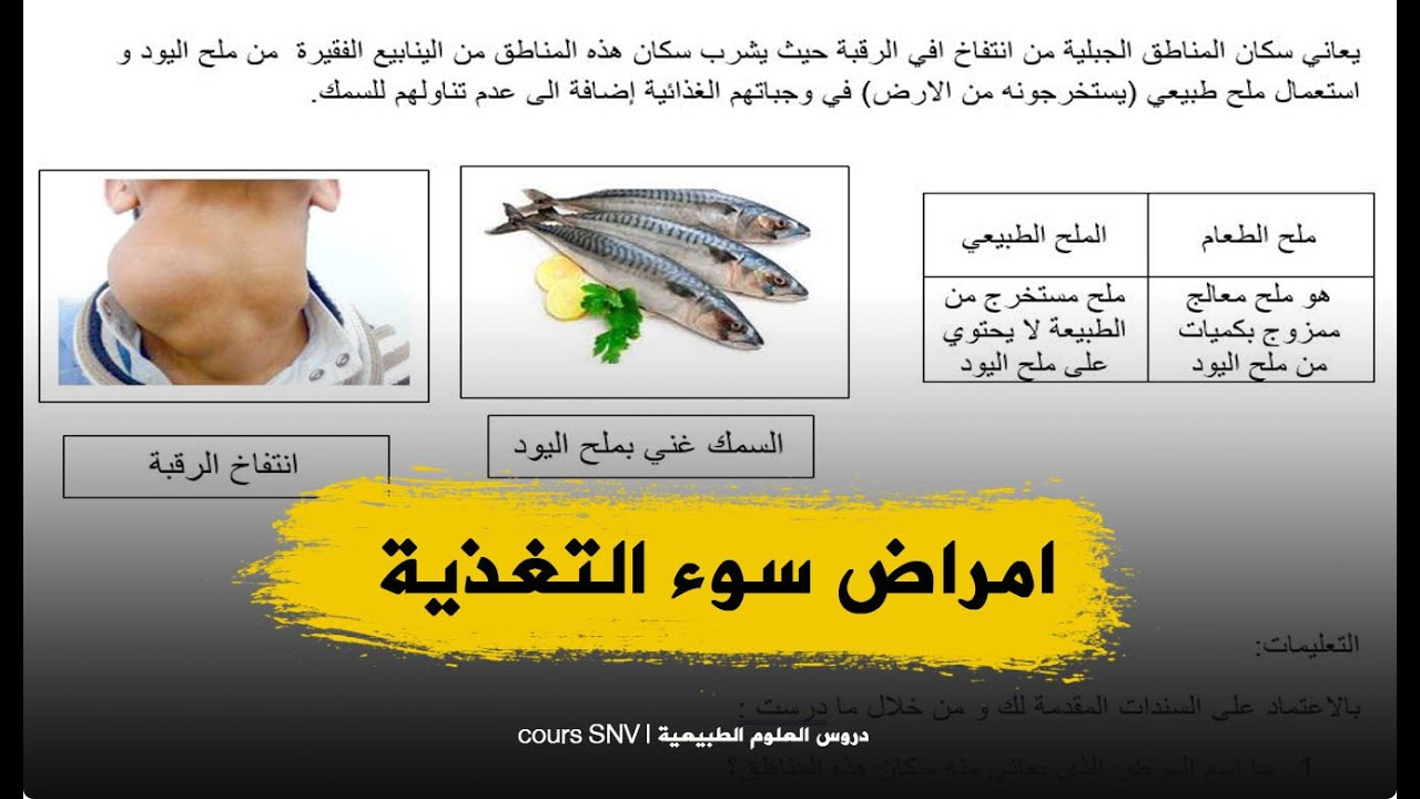 وضعية ادماجية حول امراض سوء التغذية اولى متوسط علوم طبيعية