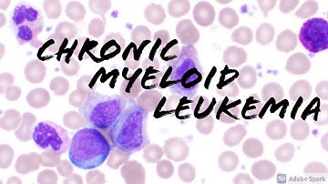 Chronic Myeloid Leukemia (CML) Peripheral Blood Smear (Hematopathology & Hematology)