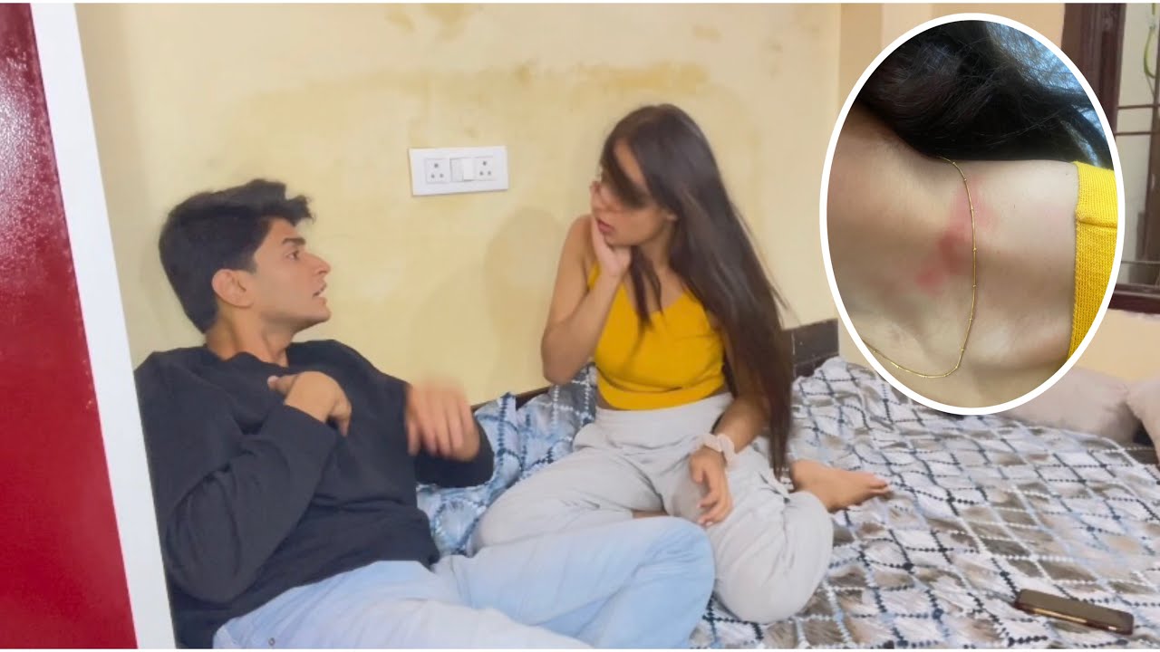 Love bite Prank on Ankit 💋 || Prank gone Wrong |He got Angry 😡#ayeshkit#couple #lovebites
