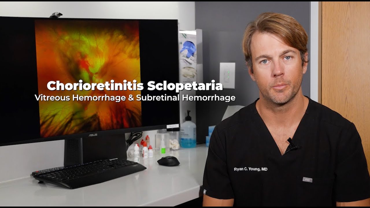 October 2024 Image of the Month | Chorioretinitis Sclopetaria | Austin Retina Assoociates