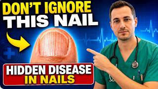 Doctor Reveal: Never Ignore These 5 Dangerous Changes on Your Nails After 60