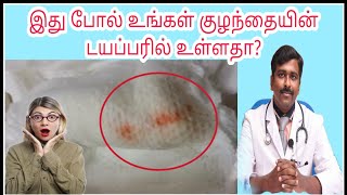 குழந்தையின் சிறுநீர் நிறம் சிவப்பாக உள்ளதா? | Red/Orange/Pink urine in baby| Tamil | Dr Sudhakar |