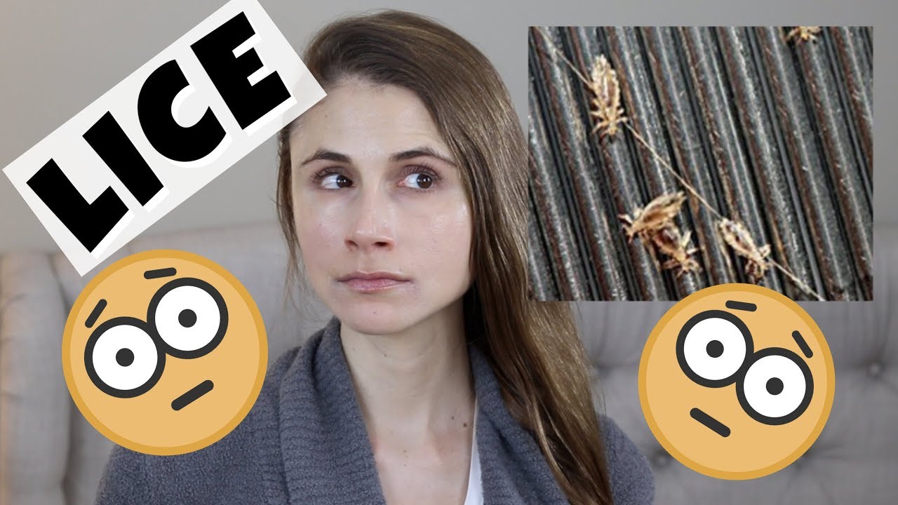 lice infestation worst case Head lice treatment at home| Dr Dray