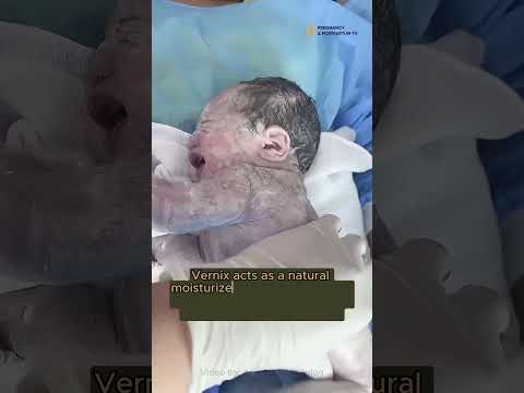 DON T Let Your Nurse Do THIS After Delivery Birth 