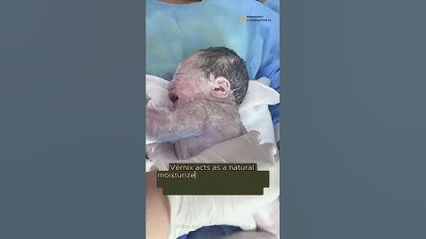 DON’T ❌ Let Your Nurse Do THIS After Delivery/Birth 🤯 ‼️