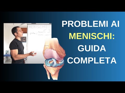 Problemi ai MENISCHI: ecco cosa fare (guida completa)