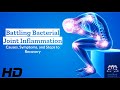 Battling Bacterial Joint Inflammation: What You Need to Know