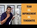 Rotator Cuff Tear, Impingement & Tendonitis Explained