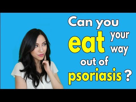 Psoriasis and Diet: Can you eat your way out of psoriasis?