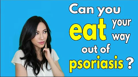 Psoriasis and Diet: Can you eat your way out of psoriasis?