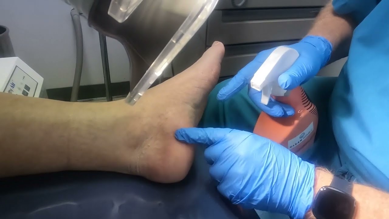006 Diabetic Foot Exam YouTube 006-diabetic-foot-exam-youtube