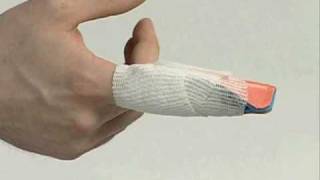 SAM Splint Simple Finger Tip Guard.wmv