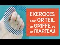 Orteil en griffe ou en marteau: infos, conseils et exercices efficaces (déformations aux pieds)