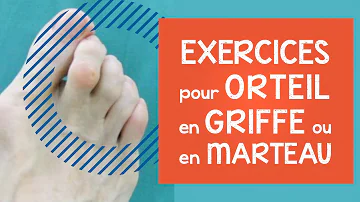 Pourquoi les orteils se mettent en griffe