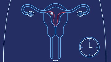 How Do You Get Pregnant? | Planned Parenthood Video