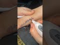 ازاله وشم محل هبه عادل اخصائيه علاج شعر وبشره Hiba8197 ازاله وشم محل هبه عادل اخصائيه علاج شعر وبشره Hiba8197