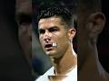 This Injury Left Ronaldo With A Broken Nose #shorts #ronaldo