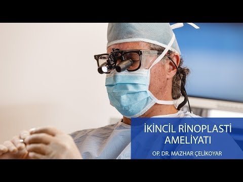 İkincil Rinoplasti Ameliyatı - Op. Dr. Mazhar Çelikoyar