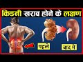 किडनी खराब होने से पहले मिलेंगे ये संकेत | Kidney Damage Symptoms Hindi