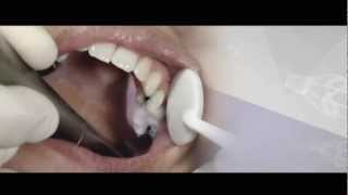 Introducing the new CEREC Omnicam at CEREC 27 & a half
