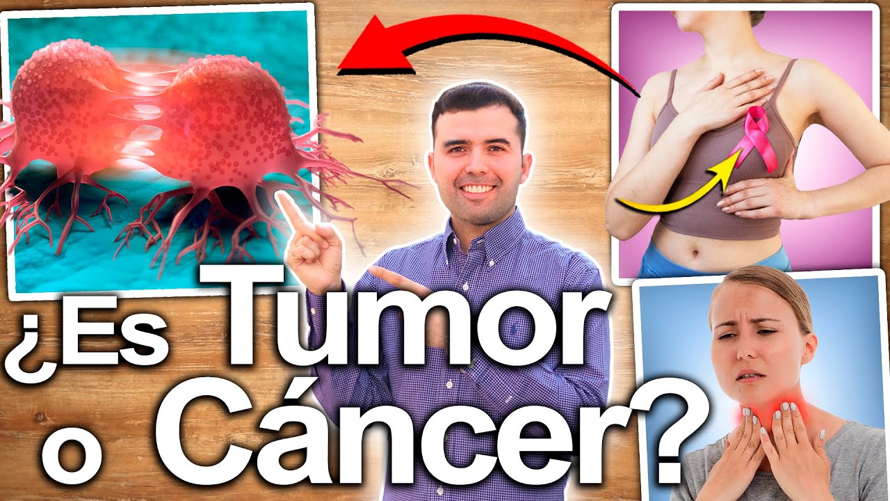 Así Empieza El Cáncer    Métodos Para Identificar, Prevenir y Combatir Los Tumores Cancerígenos