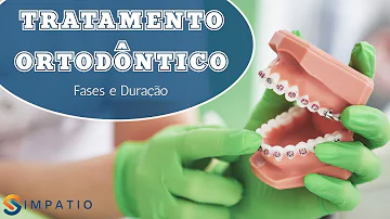 Quanto tempo dura o tratamento ortodôntico?