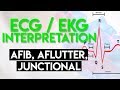 Understanding Atrial and Junctional Arrhythmias