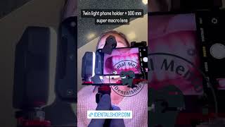 Twin light phone holder + 100 mm macro lens