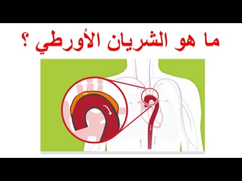 ما هو الشريان الأورطي او الابهر؟ ما هي أجزاء و تفرعات الشريان الاورطي و الأمراض التي تصيبه؟