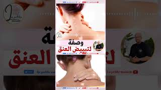 وصفة لتبييض العنق الدكتور عماد ميزاب Dr Imad Mizab  dr_imad_mizab imadmizab wasafat_imad_mizab