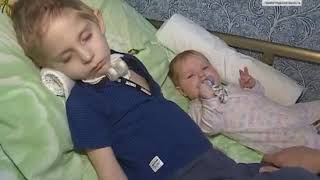 ⁣Клим Ковалев, 3 года, состояние после трепанации черепа